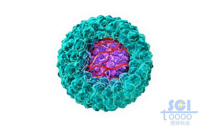 癌細(xì)胞包裹的帶微血管結(jié)構(gòu)的腫瘤