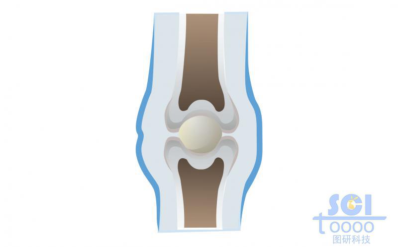 膝關(guān)節(jié)及軟骨