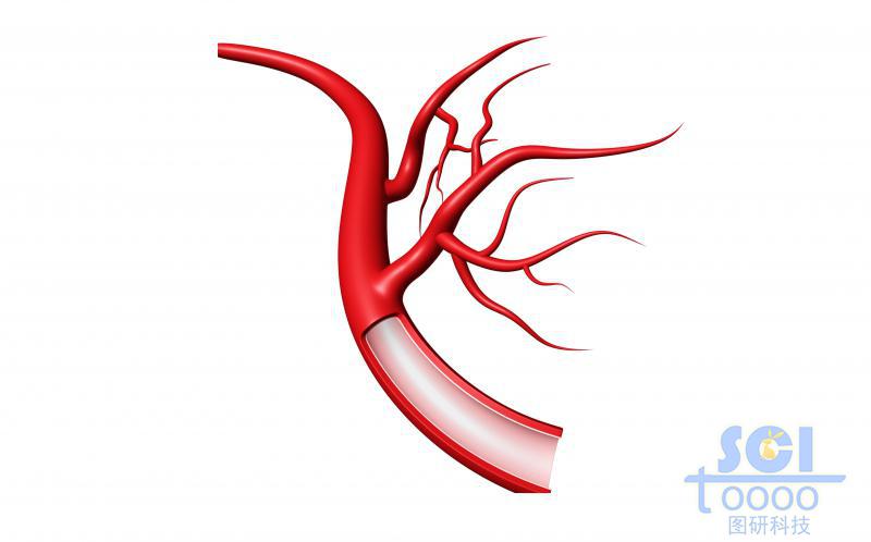 帶切口帶毛細(xì)血管分支的血管結(jié)構(gòu)