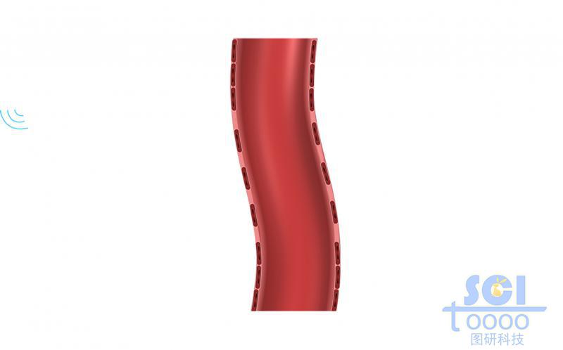 血管切面及間皮細(xì)胞