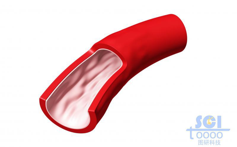 單根血管前段帶切開結(jié)構(gòu)