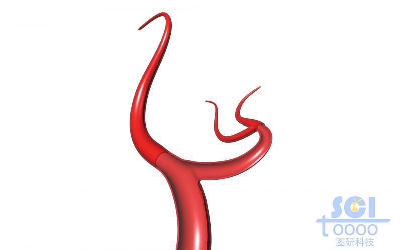 血管前段帶切開的帶分支血管結(jié)構(gòu)