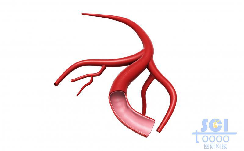 帶切口帶毛細(xì)血管分支的血管結(jié)構(gòu)