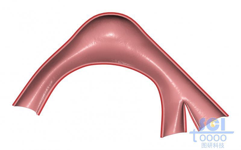 帶腫瘤結(jié)構(gòu)的半剖面的血管示意圖