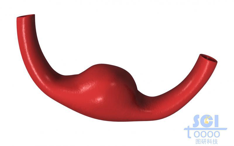 帶腫瘤結(jié)構(gòu)的血管