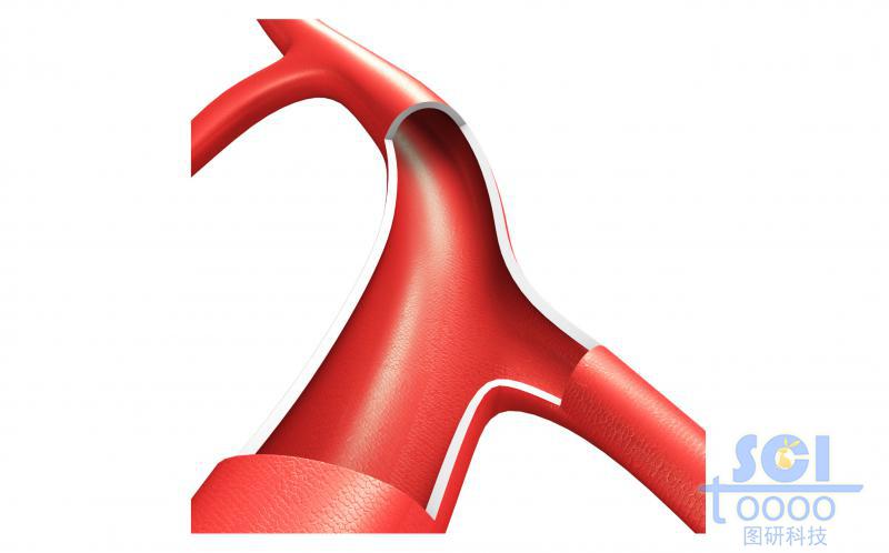 帶分支血管結構