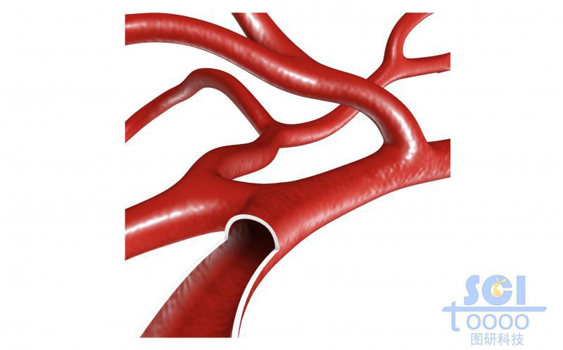 帶切口帶毛細血管分支的血管結構